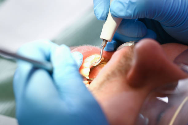 Best Emergency TMJ Treatment in Cedar Falls, IA